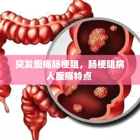 突发腹痛肠梗阻，肠梗阻病人腹痛特点 