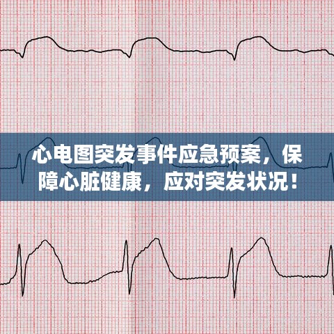 心电图突发事件应急预案，保障心脏健康，应对突发状况！
